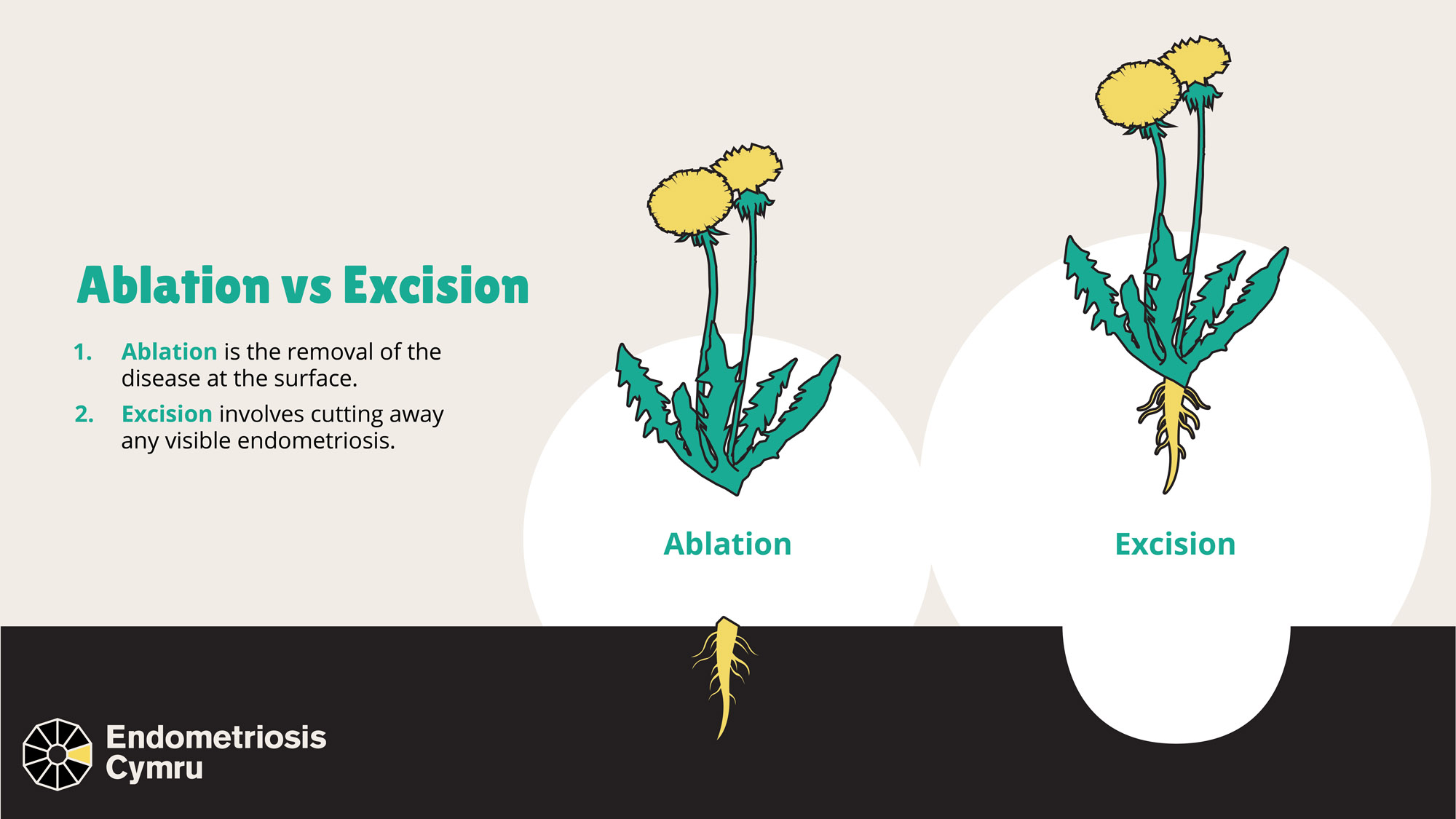 The process of ablation vs excision is illustrated using the image of a flower. With ablation, the flower is cut at the stalk, leaving the root in the ground. With excision the flower is removed entirely, including the root.
